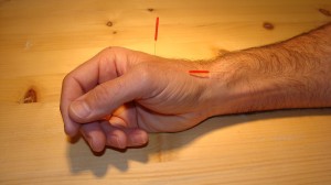 Insertion depth of acupuncture needles